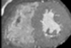 2012 04 11 12 19 02 854 2012 04 12 Safire Thumb