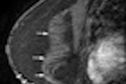 2012 04 17 12 28 03 221 2012 04 18 Mri Reconstructed Thumb