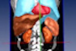 2012 04 20 11 29 46 915 2012 04 23 Volumetry Thumb