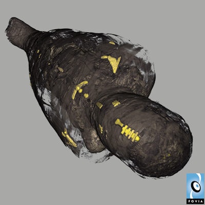 The wrapped mummy imaged from the CT scans showing the visible amulets using Fovia software. Image courtesy of and copyright of the National Museum of Scotland.