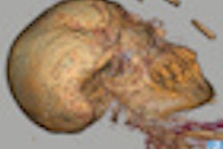 2012 04 23 09 42 46 84 2012 04 23 Rhind Mummy Thumb