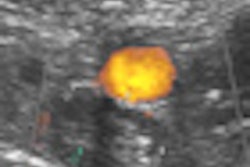 2012 04 24 12 47 36 848 2012 04 25 Dvt Thumb
