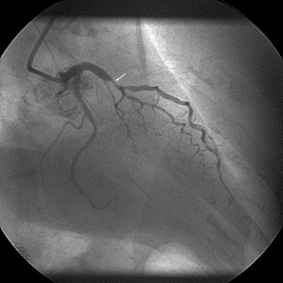 2012 04 27 08 39 44 6 2012 04 24 Ctca Fig2 B 450