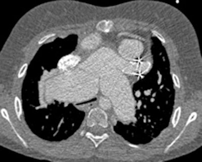 2012 05 01 10 50 59 30 2012 05 01 Pediatric Ct Fig8d