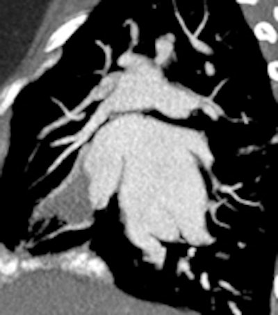 2012 05 01 10 51 01 515 2012 05 01 Pediatric Ct Fig8c