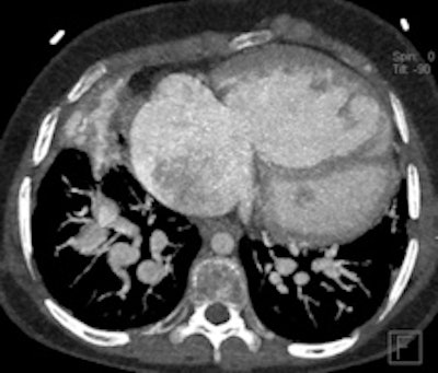 2012 05 01 10 51 04 984 2012 05 01 Pediatric Ct Fig8a