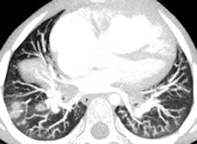 2012 05 01 10 51 05 163 2012 05 01 Pediatric Ct Fig7c