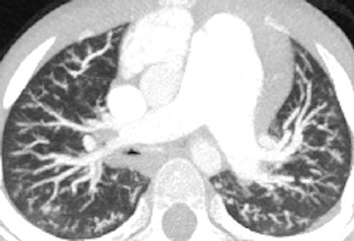 2012 05 01 10 51 08 384 2012 05 01 Pediatric Ct Fig7a