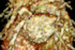 2012 05 02 08 28 28 580 2012 05 01 Pediatric Ct Thumb2