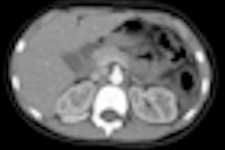 2012 05 03 10 54 13 151 10 Yr Abdominal 70x70