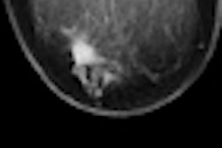 2012 05 08 10 39 20 107 2012 05 08 Photoacoustic Thumb