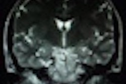 2012 05 16 10 30 22 25 34 Yr Migraine 70x70