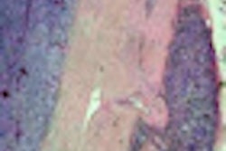 2012 05 21 08 46 09 766 2012 05 21 Drk2 Thumb