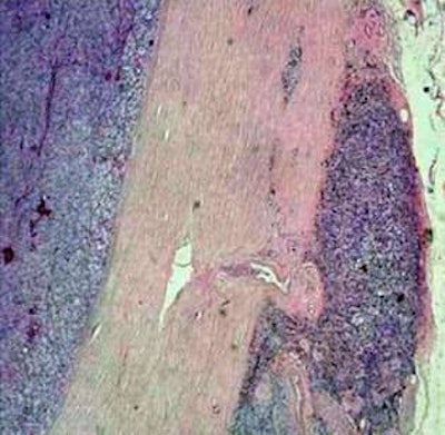 Corresponding histological specimen (HE stain, enlargement 40x), correlating well with MR microscopy.