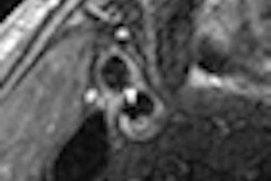 2012 05 22 10 17 27 751 2012 05 22 Drk3 Thumb