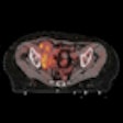 2012 05 23 11 02 22 474 2012 05 23 France Pet Ct Thumb