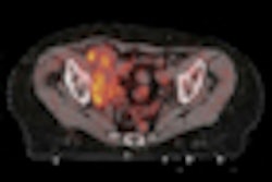 2012 05 23 11 02 22 474 2012 05 23 France Pet Ct Thumb