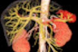 2012 05 30 08 06 49 444 2012 05 30 Overdiagnosis Hitachi Abdomen 3 D Thumb