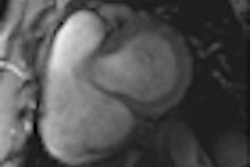 2012 05 31 11 45 43 301 2012 06 01 Niendorf Thumb