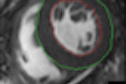 2012 06 01 11 11 23 776 2012 06 04 Ejr Cardiac Thumb