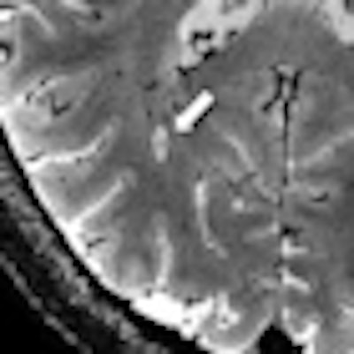 2012 06 01 11 51 18 403 7 T Mri Thumb