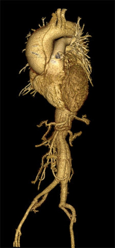 2012 06 12 11 17 00 989 2012 06 Cardiac Li image bottom