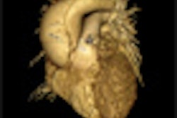 2012 06 12 11 17 01 369 2012 06 12 Cardiac Thumb