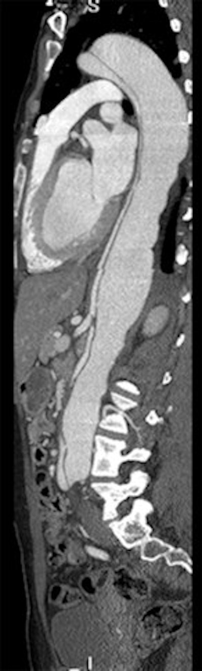 2012 06 12 11 17 04 642 2012 06 12 Cardiac Li image 3rd jpg