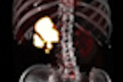 2012 06 18 10 15 04 408 2012 06 18 Esgar2