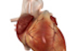 2012 06 19 09 00 30 53 Human Heart 70