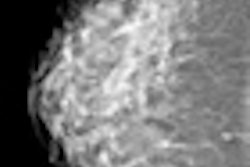 2012 06 19 12 50 18 517 2012 06 15 Mammo Thumb