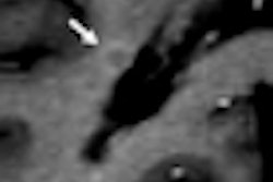 2012 06 26 11 30 27 706 Rad Gado Uspio Images Thumb