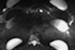 2012 06 29 15 02 24 565 2012 07 02 Implant Thumb