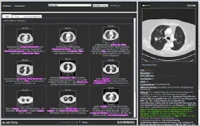 2012 07 03 11 30 27 741 2012 07 03 Rad Miner Thumb