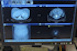 2012 07 05 11 19 22 760 2012 07 06 Euro Pacs Thumb