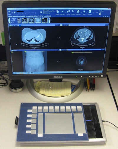 A multitouch graphics pad, adopted for use as a PACS workstation -- touch and gesture interface device with labeled virtual buttons to tap for keyboard shortcuts, plus finger slider regions for power scroll and zoom to either side of a central trackpad and gesture sensing area. Image courtesy of Cliff Edwards, McKesson Enterprise Medical Imaging.