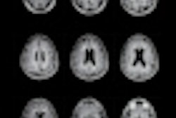 2012 07 10 09 17 43 431 Brain Mri 70