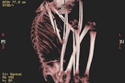 2012 07 10 12 32 16 457 2012 07 10 Mummy