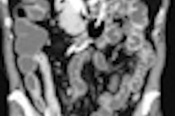 2012 07 12 08 58 14 787 2012 07 12 Small Bowel Thumb