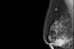 2012 07 16 09 54 31 117 Digital Mammo 70