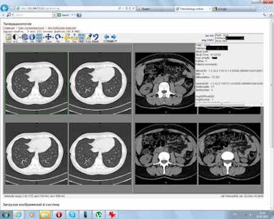 The Russian Federal Rehabilitation Center launched its own teleradiology portal.