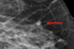 2012 07 23 14 34 42 25 2012 07 24 Breast Cad 70