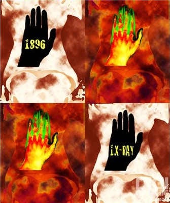 'Homage to Dr. C. Roentgen' by Dr. Christian Lauer. Image courtesy of Dr. Christian Lauer (www.christianlauer.eu).