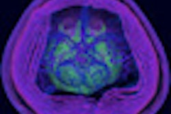2012 07 30 08 12 16 948 2012 07 30 Radiology Art Thumb2