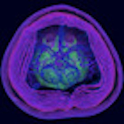 2012 07 30 08 12 16 948 2012 07 30 Radiology Art Thumb2
