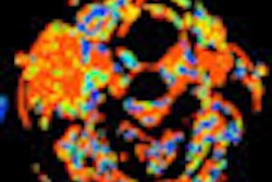 2012 07 31 13 04 03 285 2012 08 01 Pet Ct Thumb