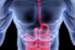 2012 08 13 09 58 55 2 Intestine 70
