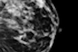 2012 08 14 10 07 58 181 Digital Mammo2 70