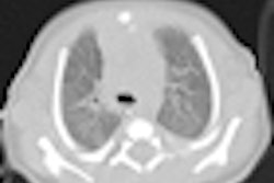 2012 08 15 08 57 24 502 2012 08 15 Pediatrict Ct Thumb