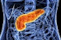 2012 08 16 14 26 45 363 Pancreas 70